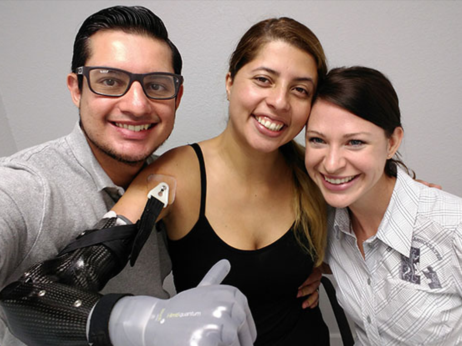 three people posing for image the girl in the middle has a prosthetic arm